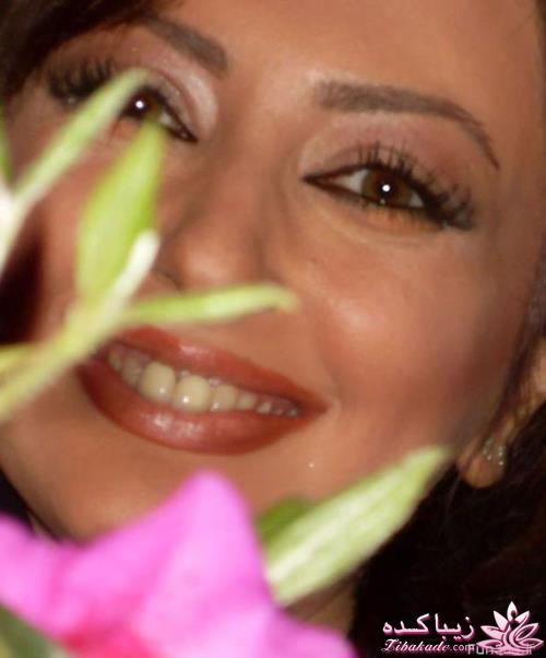 قبل و بعد از عمل بازیگران ایرانی